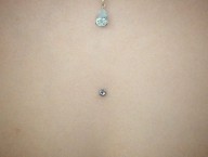 microdermal sternum