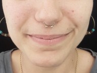 Gold septum