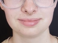 Gold septum