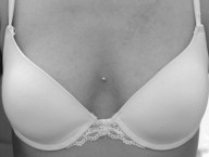 microdermal sternum