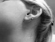 lobe transversal