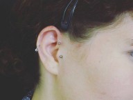 Hélix - Anti Helix -Tragus