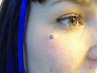 microdermal pommette 