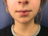 Labret vertical