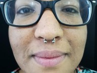 Septum freehand