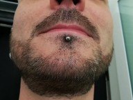 Septum freehand  (Labret cicatrisé)